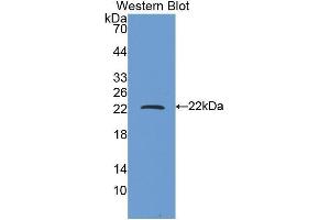 Western Blotting (WB) image for anti-Ferritin, Heavy Polypeptide 1 (FTH1) (AA 1-171) antibody (ABIN1078026) (FTH1 抗体  (AA 1-171))