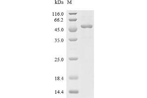 Dual Specificity Phosphatase 6 (DUSP6) (AA 1-381), (full length) protein (His tag)