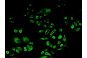 Detection of PSAP in Human Hela Cells using Polyclonal Antibody to Prosaposin (PSAP) (Prosaposin 抗体  (AA 17-524))