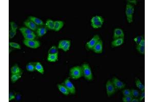 Immunofluorescent analysis of HepG2 cells using ABIN7146228 at dilution of 1:100 and Alexa Fluor 488-congugated AffiniPure Goat Anti-Rabbit IgG(H+L) (P-Cadherin 抗体  (AA 117-360))