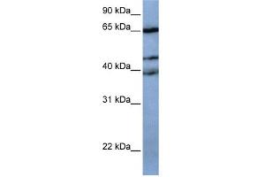 WB Suggested Anti-ZNF681 Antibody Titration:  0. (ZNF681 抗体  (N-Term))