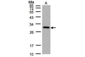 WB Image Sample (30 ug of whole cell lysate) A: 293T 12% SDS PAGE CTDSP2 antibody antibody diluted at 1:1000 (CTDSP2 抗体  (Center))