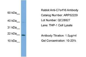 WB Suggested Anti-C7orf16  Antibody Titration: 0.