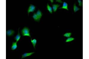 Immunofluorescence staining of Hela Cells with ABIN7127821 at 1:50, counter-stained with DAPI. (Recombinant SOX1 抗体)