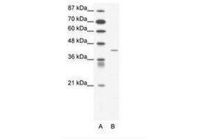 Image no. 1 for anti-Somatostatin Receptor 4 (SSTR4) (AA 163-212) antibody (ABIN202399) (SSTR4 抗体  (AA 163-212))