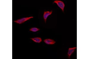 ABIN6263791 and ABIN6273277 staining Hela by IF/ICC. (OBFC2A 抗体  (Internal Region))