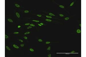 Immunofluorescence of purified MaxPab antibody to HNRNPUL1 on HeLa cell. (HNRNPUL1 抗体  (AA 1-804))