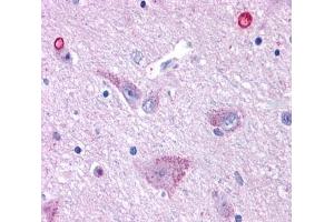 Anti-GPR50 antibody  ABIN1049060 IHC staining of human brain, hypothalamus. (GPR50 抗体  (Cytoplasmic Domain))
