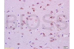 Formalin-fixed and paraffin embedded rat brain labeled with Anti-5-HTR1A/HTR1A Polyclonal Antibody, Unconjugated (ABIN738006) at 1:200 followed by conjugation to the secondary antibody and DAB staining. (Serotonin Receptor 1A 抗体  (AA 301-400))