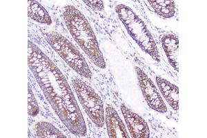 IHC analysis of CD2AP using anti-CD2AP antibody (ABIN6719544).