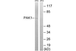 Western blot analysis of extracts from 3T3 cells, treated with UV (15mins), using PAK1 (epitope around residue 204) antibody. (PAK1 抗体  (Ser204))