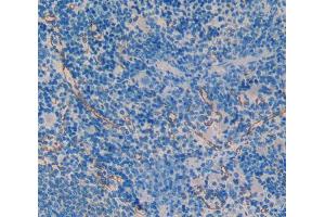 IHC-P analysis of spleen tissue, with DAB staining. (SMAD1 抗体  (AA 273-468))