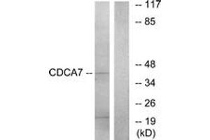Western Blotting (WB) image for anti-Cell Division Cycle Associated 7 (CDCA7) (AA 141-190) antibody (ABIN2889904) (CDCA7 抗体  (AA 141-190))