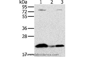 Western blot analysis of Raji cell and human liver cancer tissue, hela cell, using NDUFAF2 Polyclonal Antibody at dilution of 1:250 (NDUFAF2 抗体)