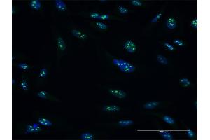 Immunofluorescence of purified MaxPab antibody to PES1 on HeLa cell. (PES1 抗体  (AA 1-588))