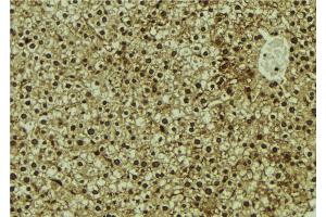 ABIN6273102 at 1/100 staining Mouse liver tissue by IHC-P. (CMIP 抗体  (C-Term))