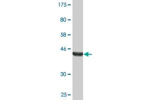 Western Blot detection against Immunogen (38. (STK3 抗体  (AA 311-431))