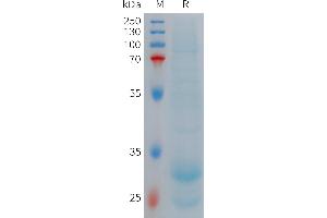 SDS-PAGE (SDS) image for Hepcidin Antimicrobial Peptide (HAMP) (AA 60-84) protein (Fc Tag) (ABIN7491465)