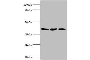 Western blot All lanes: ADP-ribosylation factor GTPase-activating protein 1 antibody at 8 μg/mL Lane 1: PC-3 whole cell lysate Lane 2: Hela whole cell lysate Lane 3: Mouse brain tissue Secondary Goat polyclonal to rabbit IgG at 1/10000 dilution Predicted band size: 45, 46, 32, 40 kDa Observed band size: 45 kDa (ARFGAP1 抗体  (AA 1-220))