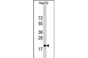 Western blot analysis of p27Kip1 Antibody (C-term) 6269b in HepG2 cell line lysates (35 μg/lane). (CDKN1B 抗体  (C-Term))