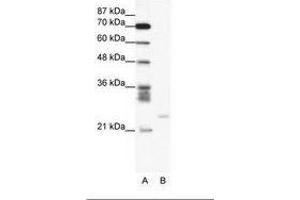 Image no. 1 for anti-BCL2-Related Protein A1 (BCL2A1) (C-Term) antibody (ABIN6736048) (BCL2A1 抗体  (C-Term))