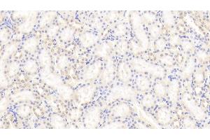Immunohistochemistry (IHC) image for anti-Peptidylprolyl Isomerase A (Cyclophilin A) (PPIA) (AA 2-164) antibody (ABIN7432967)