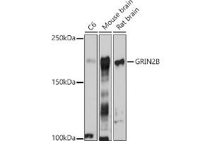 Western blot analysis of extracts of various cell lines, using GRIN2B antibody (ABIN3017275, ABIN3017276, ABIN3017277 and ABIN1680110) at 1:1000 dilution. (GRIN2B 抗体  (C-Term))