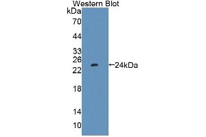 Western Blotting (WB) image for anti-Protein Tyrosine Phosphatase Type IVA, Member 1 (PTP4A1) (AA 1-173) antibody (ABIN5014212)