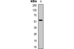 Western blot analysis of MCT12 expression in Jurkat (A) whole cell lysates. (SLC16A12 抗体)
