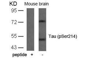Western blot analysis of extracts from mouse brain tissue using Tau(Phospho-Ser214) Antibody and the same antibody preincubated with blocking peptide. (MAPT 抗体  (pSer214))