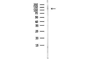 anti-DEAH (Asp-Glu-Ala-His) Box Polypeptide 30 (DHX30) antibody