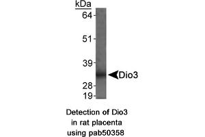 Image no. 1 for anti-Deiodinase, Iodothyronine, Type III (DIO3) (AA 250-300) antibody (ABIN363667) (DIO3 抗体  (AA 250-300))