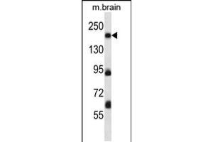 Western blot analysis in mouse brain tissue lysates (35ug/lane). (MAP4K4 抗体  (AA 506-534))