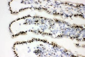 IHC analysis of XRCC1 using anti-XRCC1 antibody (ABIN5693138).