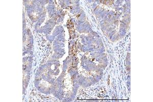 IHC analysis of RBP1 using anti-RBP1 antibody (ABIN7599586). (RBP1 抗体  (AA 10-135))
