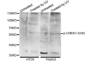 Western blot analysis of extracts of various cell lines, using Phospho-CHEK1-S345 antibody. (CHEK1 抗体  (pSer345))
