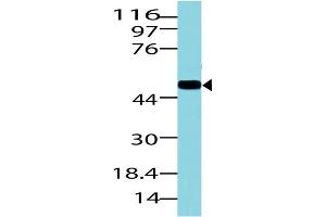 Image no. 1 for anti-Solute Carrier Family 2 (Facilitated Glucose Transporter), Member 1 (SLC2A1) (AA 193-362) antibody (ABIN5027222)