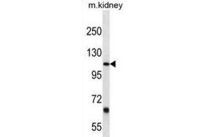 Western Blotting (WB) image for anti-Prostaglandin F2 Receptor Negative Regulator (PTGFRN) antibody (ABIN3000257) (PTGFRN 抗体)