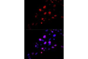 Immunofluorescence analysis of U2OS cells using Rad18 antibody (ABIN6128609, ABIN6146628, ABIN6146630 and ABIN6217430). (RAD18 抗体  (AA 216-495))