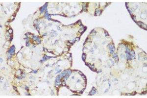 Immunohistochemistry (Paraffin-embedded Sections) (IHC (p)) image for anti-Enoyl Coenzyme A Hydratase 1, Peroxisomal (ECH1) antibody (ABIN7256490)