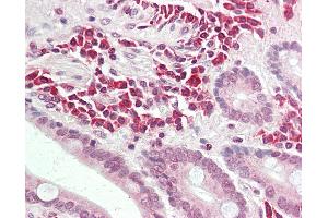 Anti-ALK3 / BMPR1A antibody IHC staining of human small intestine. (BMPR1A 抗体  (AA 170-197))