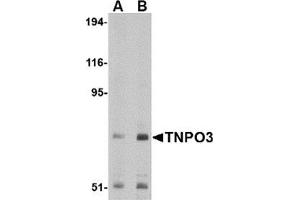 Western blot analysis of TNPO3 in Raji cell lysate with TNPO3 antibody at (A) 1 and (B) 2 μg/ml. (Transportin 3 抗体  (N-Term))
