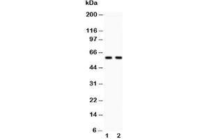 Western Blotting (WB) image for anti-Proto-oncogene tyrosine-protein kinase Src (Src) (AA 614-826) antibody (ABIN3029555)