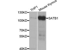 Western blot analysis of extracts of various cell lines, using SATB1 antibody. (SATB1 抗体)