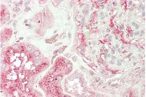 ABIN768594 (5µg/ml) staining of paraffin embedded Human Kidney. (UNC13B 抗体  (Internal Region))