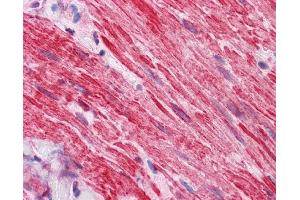 IHC Information: Paraffin embedded small intestine, muscularis propria tissue, tested with an antibody dilution of 5 ug/ml. (DVL2 抗体  (N-Term))