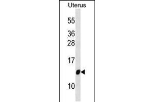 Western blot analysis in Uterus tissue lysates (35ug/lane). (TIMM10 抗体  (AA 21-49))