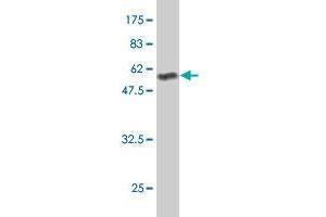 Western Blotting (WB) image for anti-Phosphatidic Acid Phosphatase Type 2B (PPAP2B) (AA 1-311) antibody (ABIN563713)
