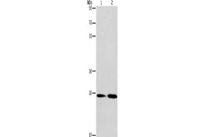Gel: 8 % SDS-PAGE, Lysate: 40 μg, Lane 1-2: Mouse kidney tissue, Mouse liver tissue, Primary antibody: ABIN7130344(NAT8 Antibody) at dilution 1/237. (NAT8 抗体)