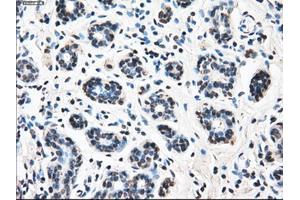 Immunohistochemical staining of paraffin-embedded breast tissue using anti-LEMD3 mouse monoclonal antibody. (LEMD3 抗体)